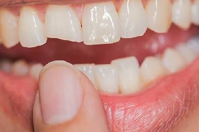 tooth-sensitivity-and-tooth-erosion