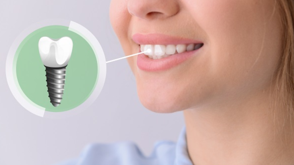 Dental Treatments Chennai