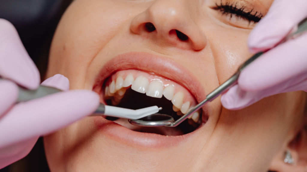 Best Dental Implants in Chennai