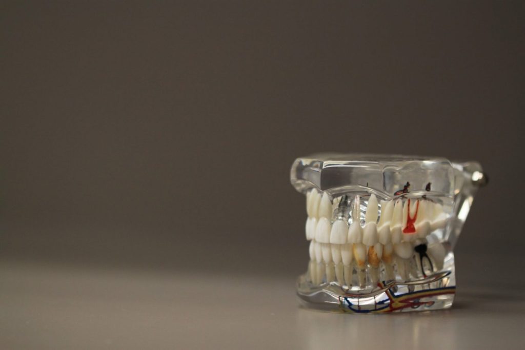 Invisible Aligners First Week Pain