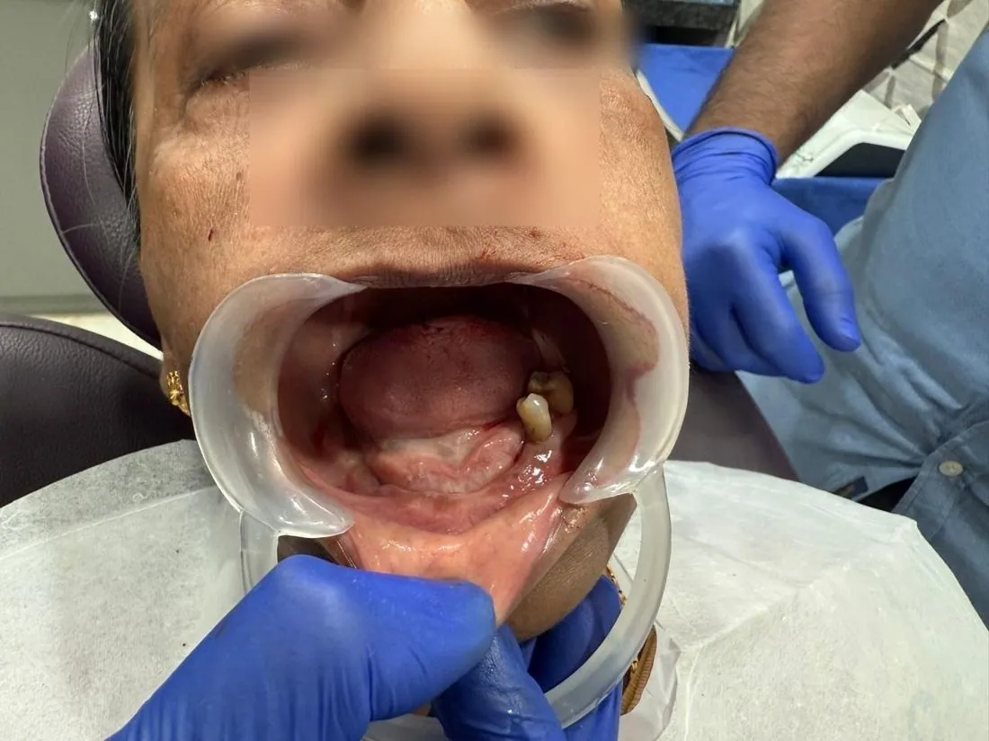 Lower jaw with mouth open, eyes blurred