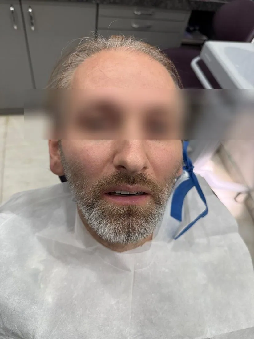 Patient portrait with face blurred