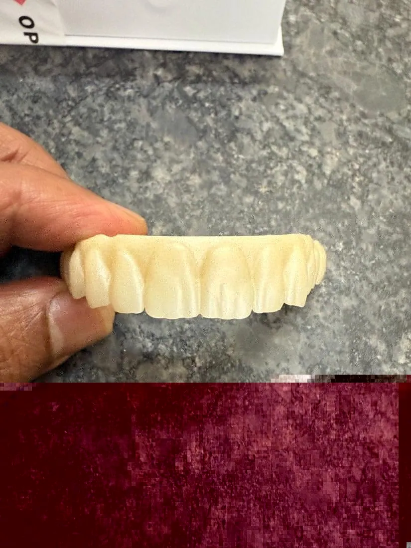 Finished upper prosthesis held in hand