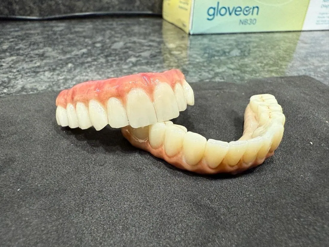 Upper and lower prosthesis side by side
