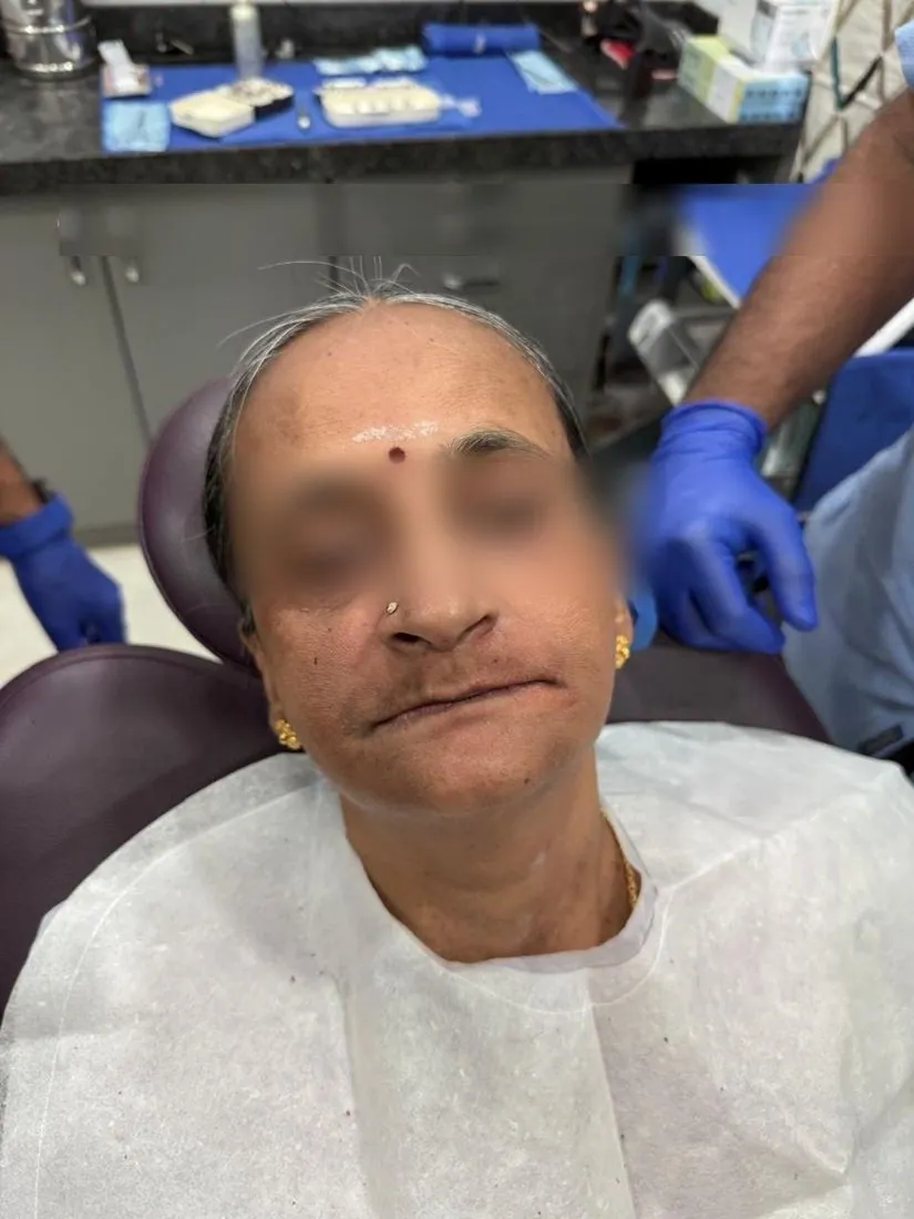 Patient portrait before treatment, eyes blurred