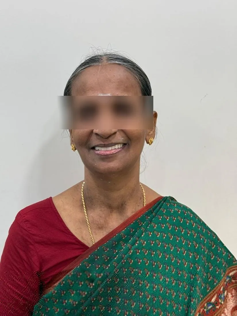 Patient smiling after treatment, eyes blurred