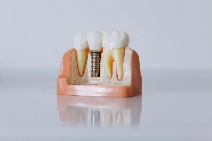 Strong anchorage in dense bone