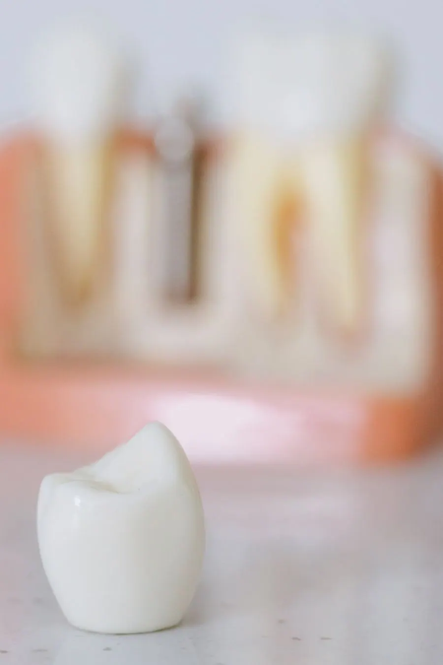 Complex case implant solutions
