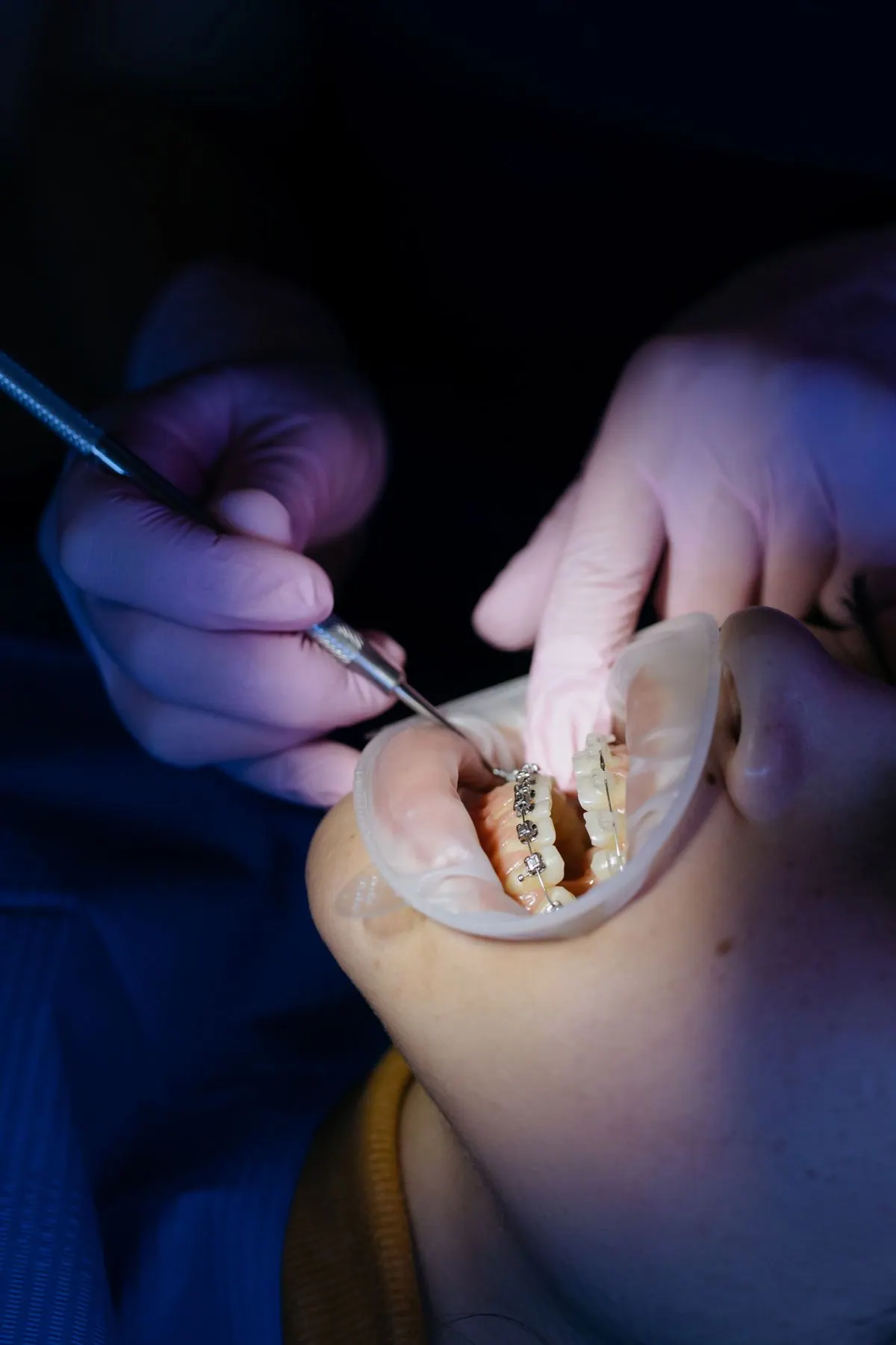 Dental treatment procedure