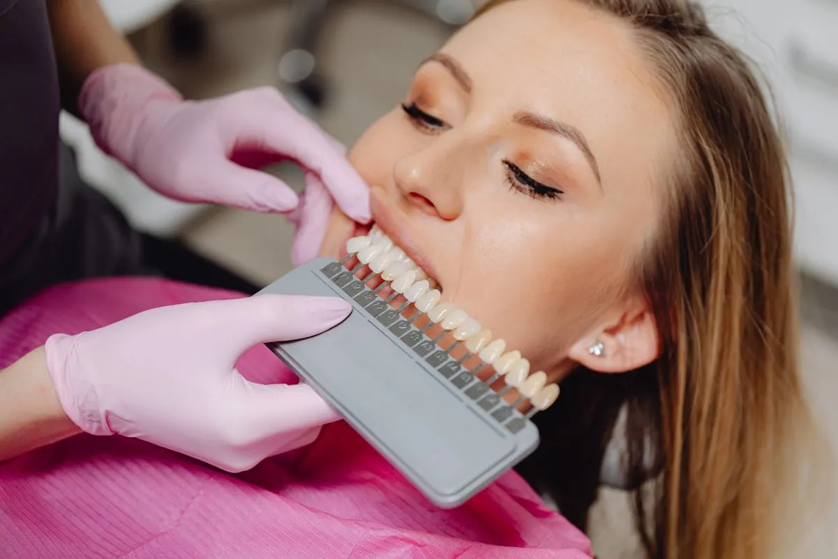 Smile makeover consultation