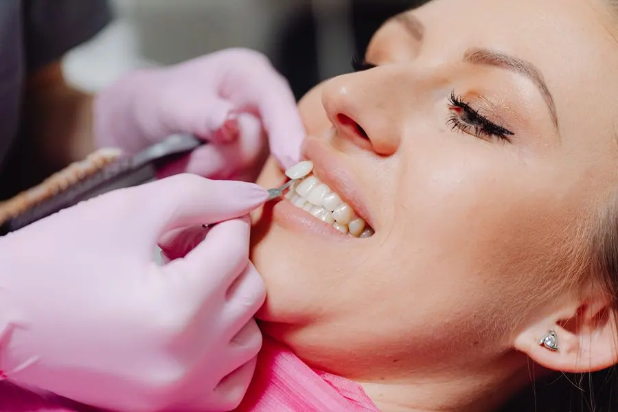 Smile makeover treatment