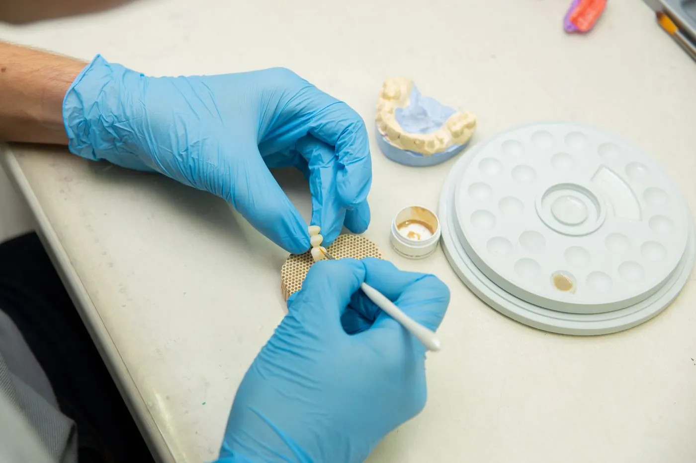 Dental technician crafting a ceramic crown in Akeela Dental Care's in-house laboratory