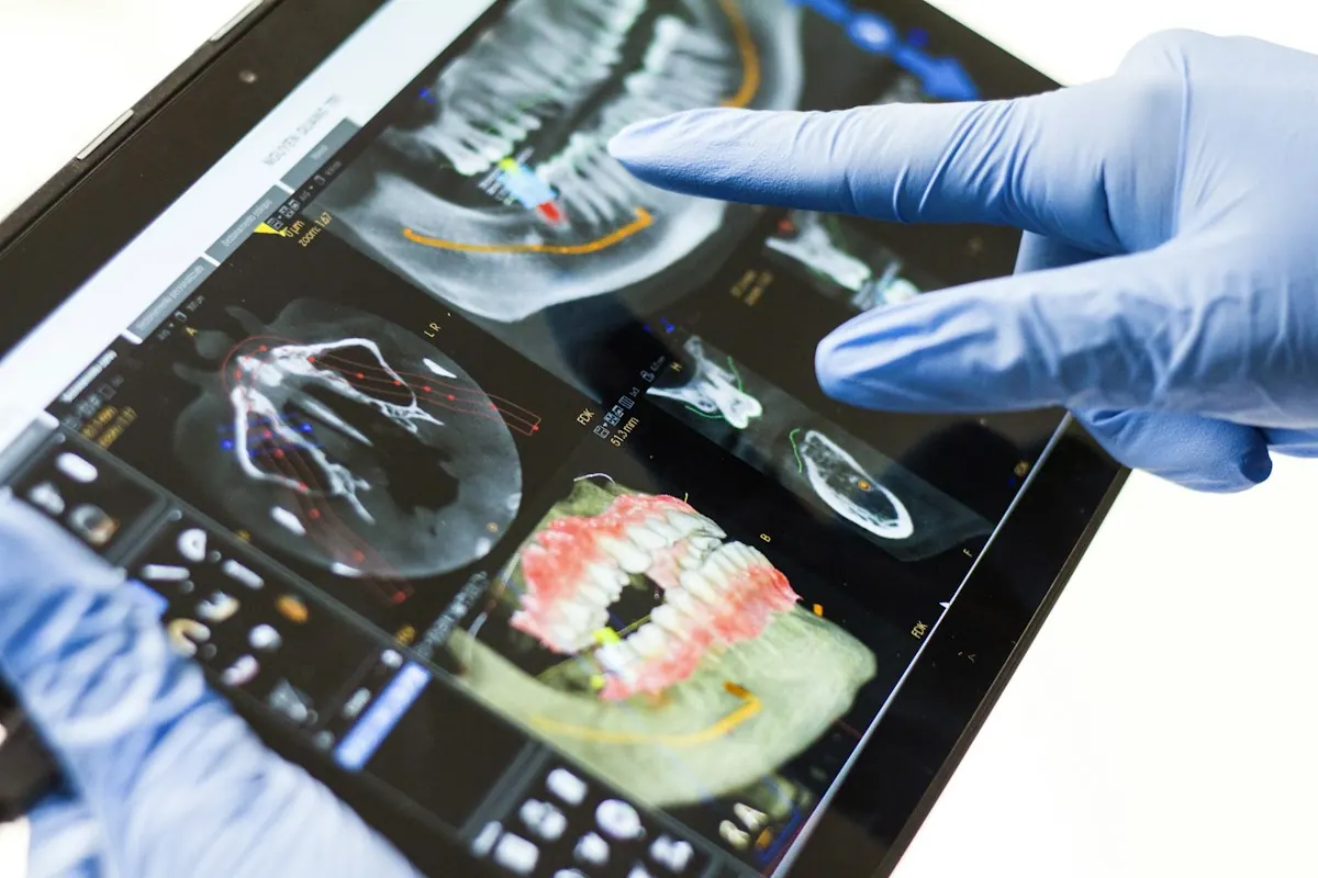 Dental implant restoration