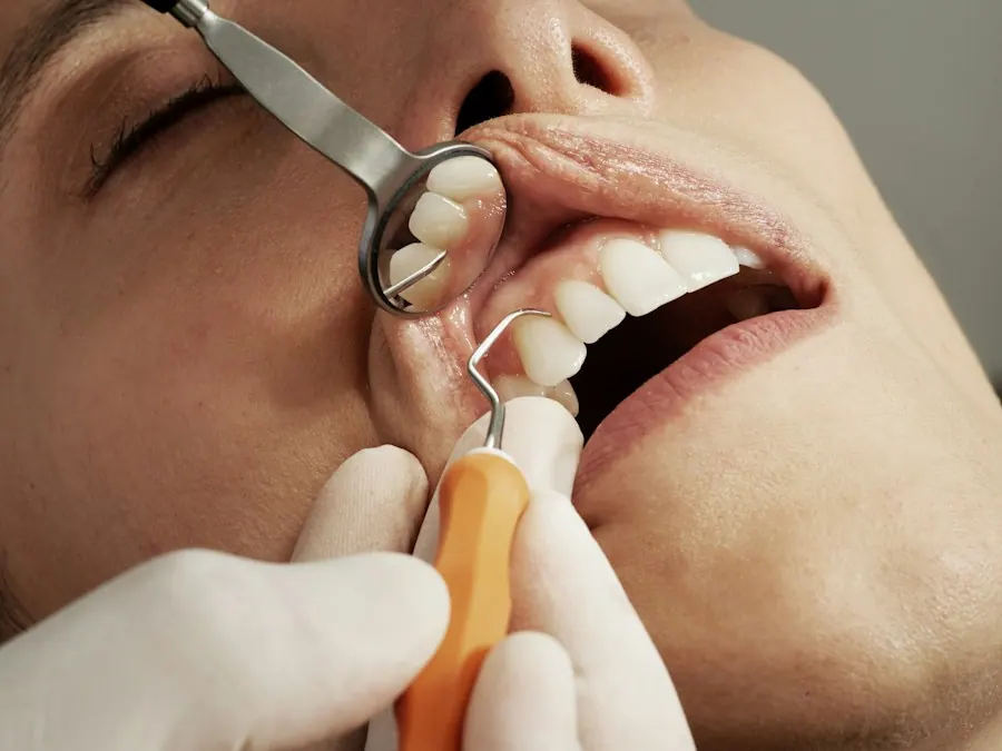 Fixed teeth restoration