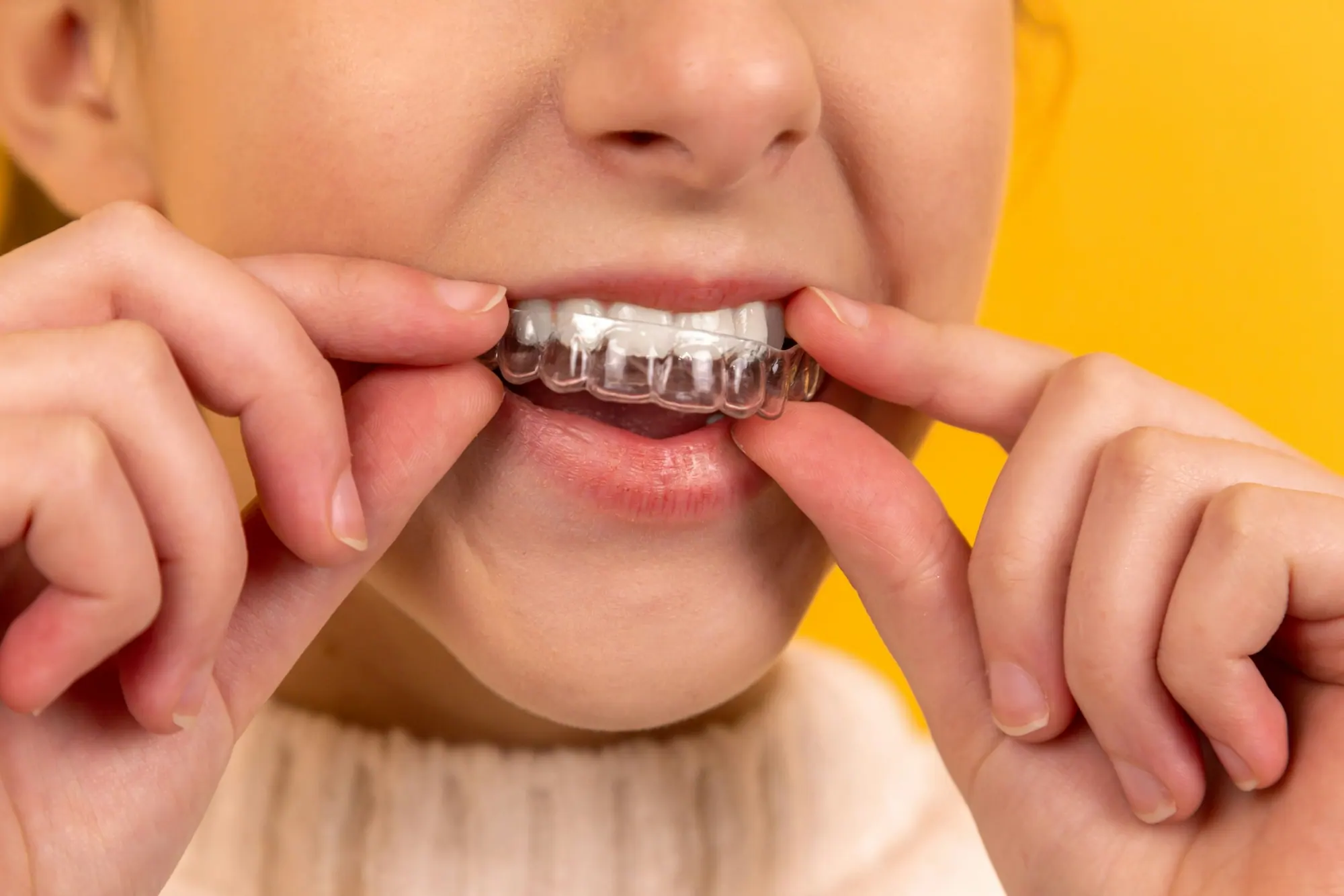 Sedation Dentistry Chennai | Akeela Dental Care