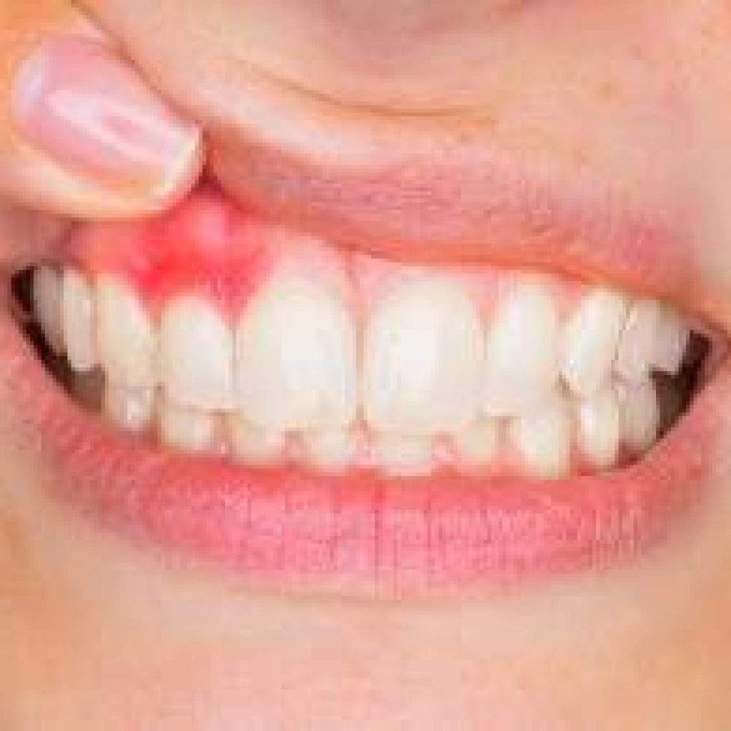 Top 5 Reasons For Shaking Teeth