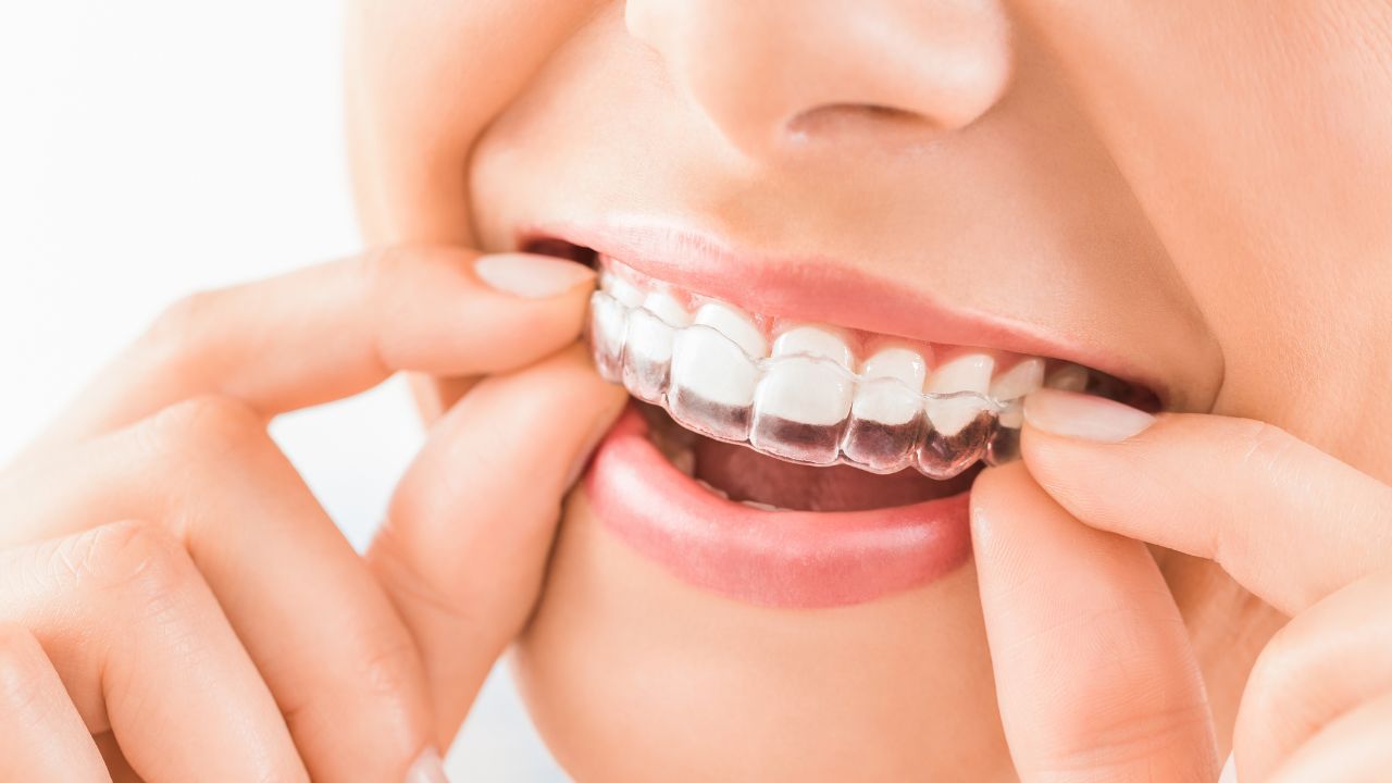 affordable dental implants chennai